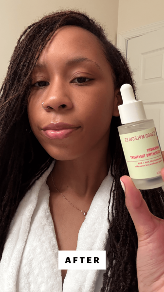 Taylor after applying the Good Molecules Overnight Exfoliating Face Treatment